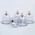 ventouses cupping relaxation recuperation et bienfaits multiples 476 1