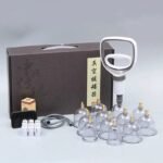 ventouses cupping relaxation recuperation et bienfaits multiples 948 1